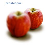 Presbiopia